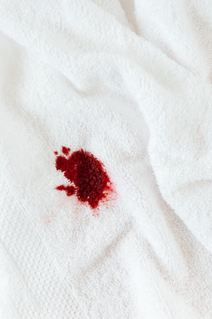 Same day cleaning Bromley emergency stain removal service